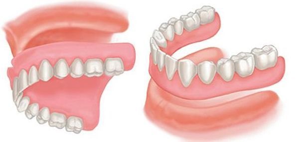 complete denture